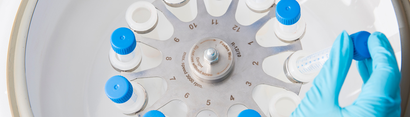 Blue gloved hand putting test tubes in a circular container